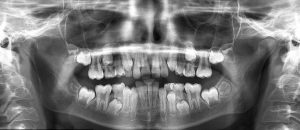 Dental Centre Kenmore - Children's Dentistry