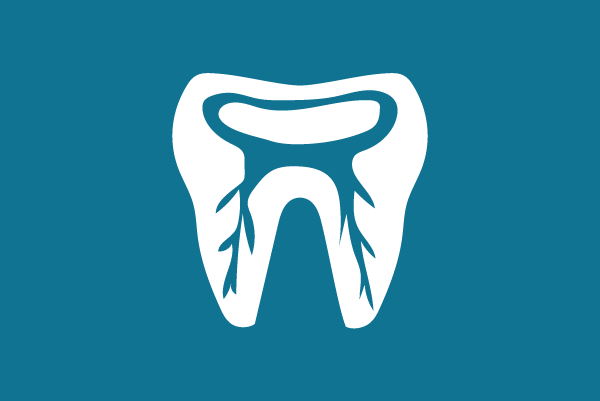 Dental Centre Kenmore - Root Canal