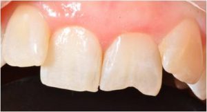 Kenmore Dental Centre - Emergency Dental Treatment