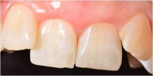 Kenmore Dental Centre - Emergency Dental Treatment